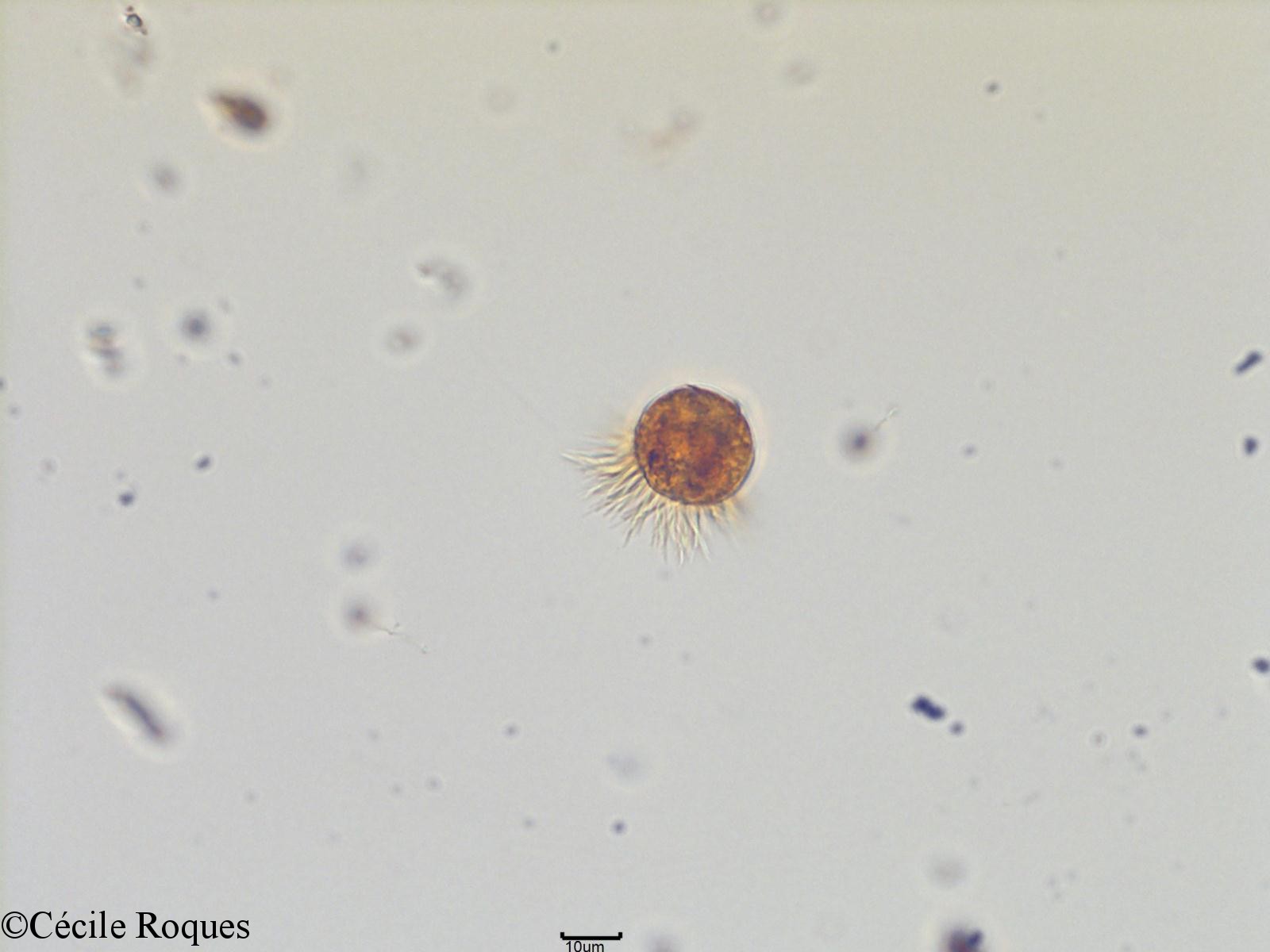 protozoo/Leegardiella sp (2)(copy).jpg